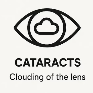 Cataracts