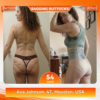Moringa & Berberine 5-In-1 Micro-Particle sculpting & Fat-Burn shorts